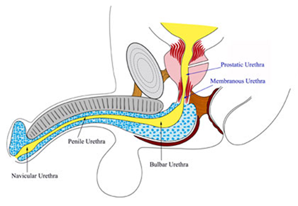 Urethral Stricture in men